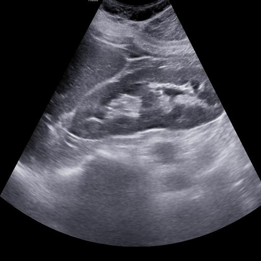 kidney