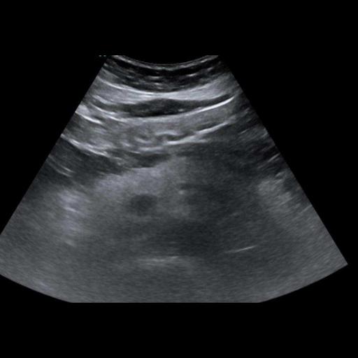 Ultrasound 1