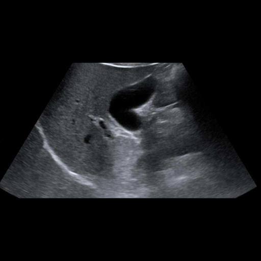 Ultrasound 2
